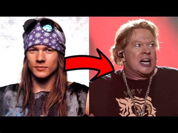 AXL ROSE NOW: THE EVOLUTION OF ROCKS ICONIC FRONTMAN