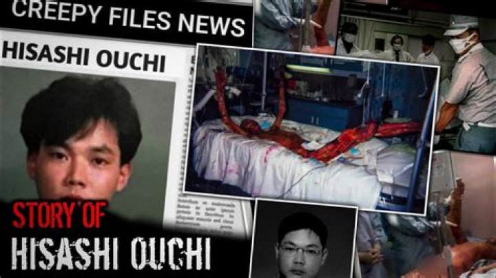 Hisashi Ouchi Real Photos: Uncovering the Truth Behind a Tragic Story