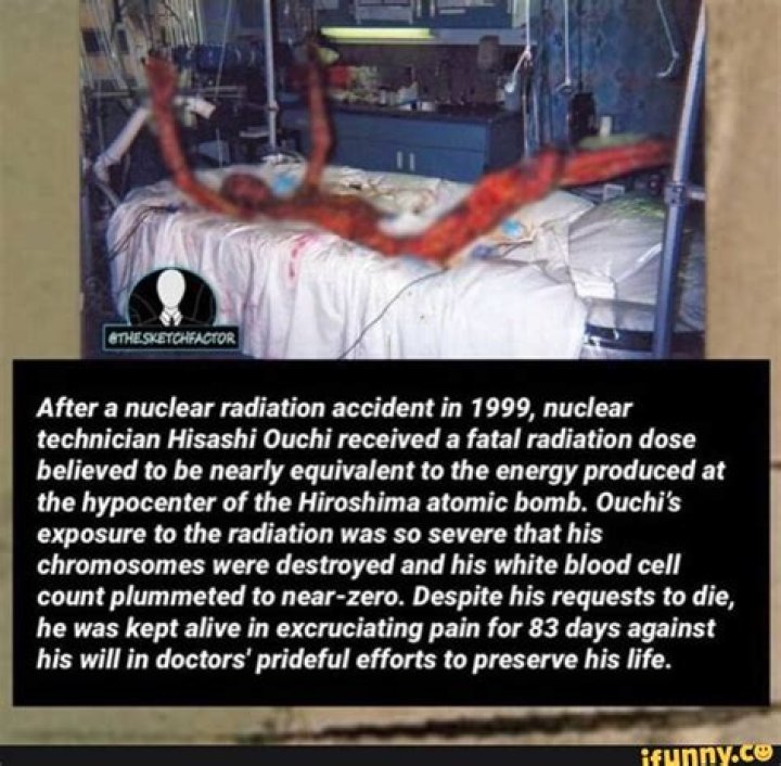Hisashi Ouchi: The Unthinkable Agony of Extreme Radiation Exposure