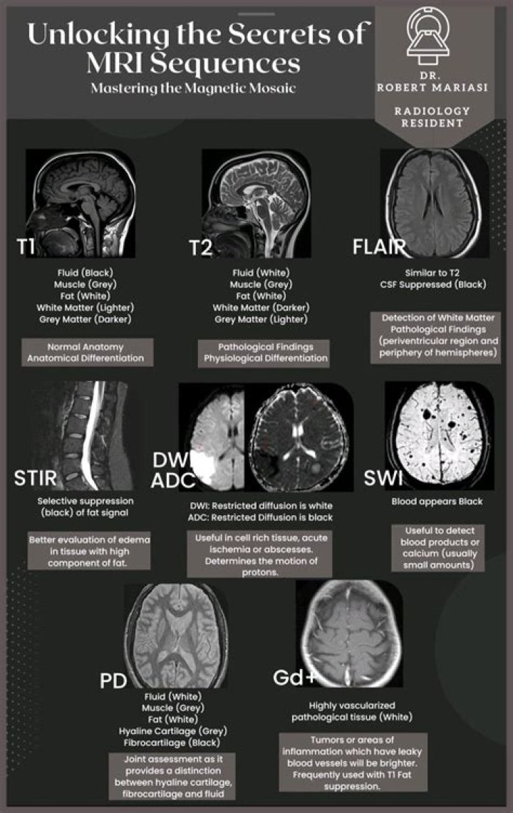 HSODA-052: Unlocking the Secrets Behind This Viral Sensation