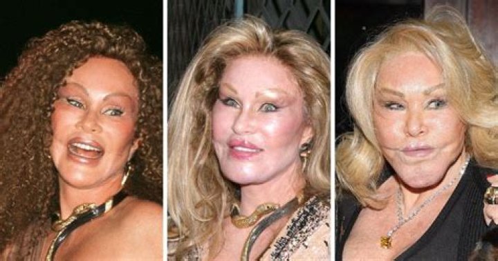 Jocelyn Wildenstein's Early Years: A Journey Through Glamour and Transformation