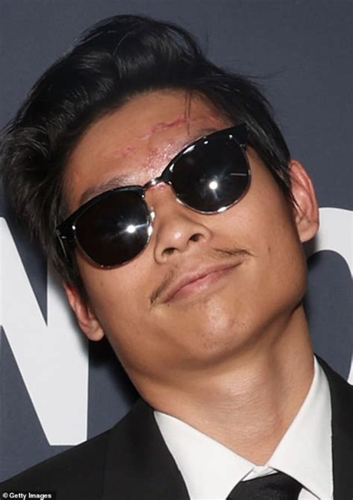 Pax Jolie Pitt: His Recent Journey from Accident to Red Carpet