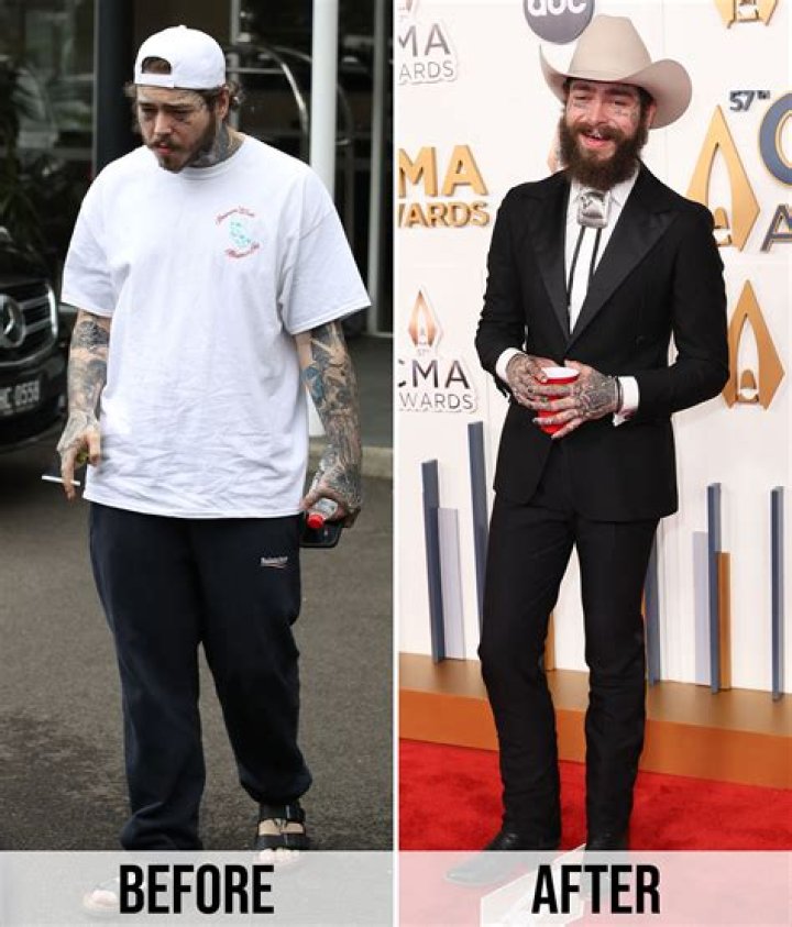 Post Malone's Weight Loss Journey: How He Got So Thin