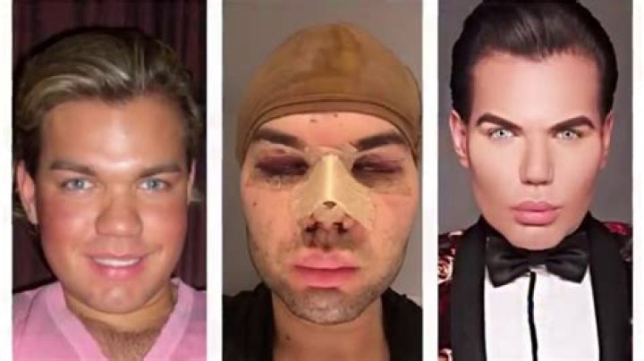 Rodrigo Alves: The Plastic Surgery King's Journey and His Impact on the Beauty Industry
