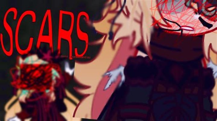 Scars.Wonderland Leaks: Unveiling New Insights on Skin Recovery