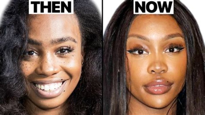 SZA Before Lip Filler: Tracing Her Journey and Evolving Look
