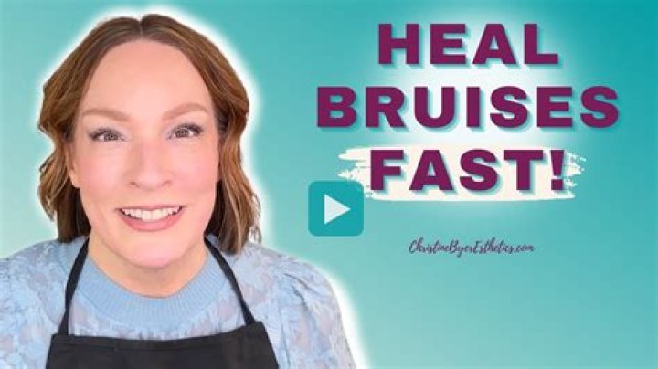 Unpacking Bruised Bonnie: Finding Strength and Healing