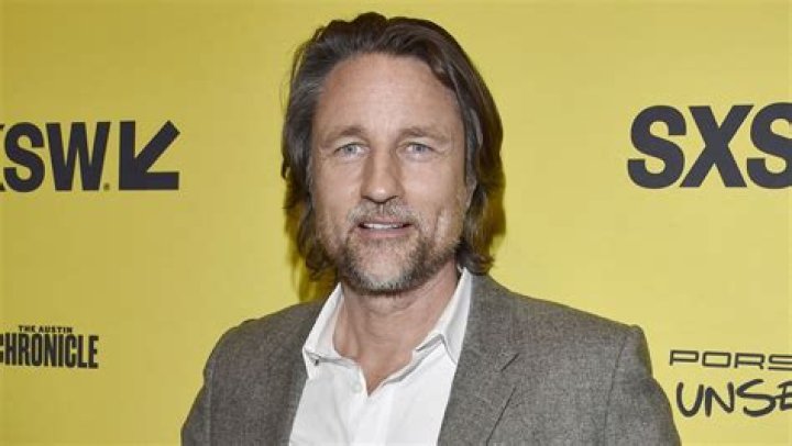 Unveiling the Truth About Martin Henderson Plastic Surgery: A Comprehensive Deep Dive