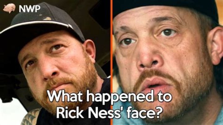 What Happened To Rick Ness Nose