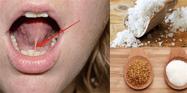 What is Sal Debajo de la Lengua and How Does it Work? Unlocking the Secrets Beneath Your Tongue